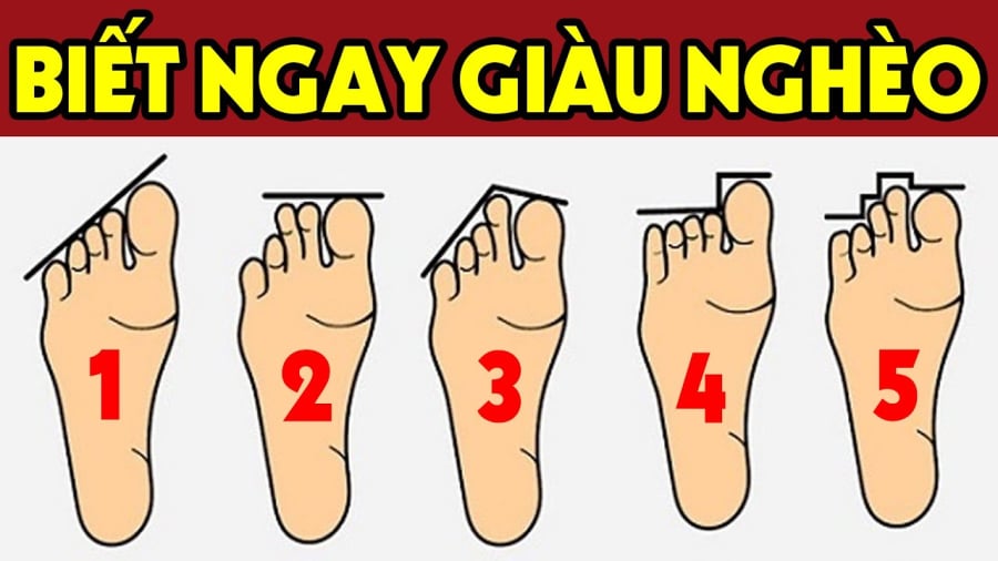 tuong ban chan giau ngheo