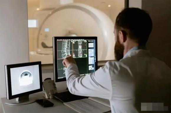 chụp ct, ᴜng thư