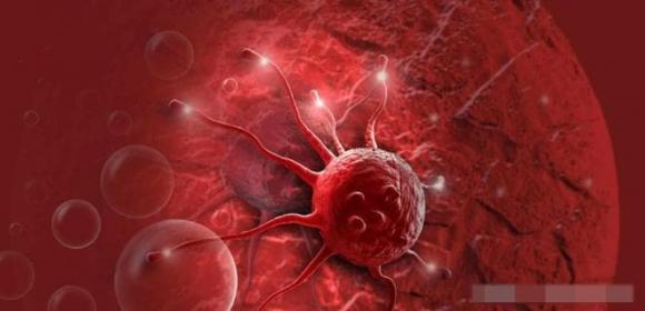 khṓi ᴜ ác tính